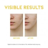 ootd-dark-spot-vitamin-c-serum-ορός-βιταμίνης-c-για-σκούρες-κηλίδες (1)