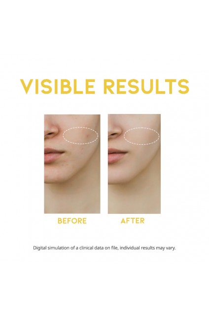 ootd-dark-spot-vitamin-c-serum-ορός-βιταμίνης-c-για-σκούρες-κηλίδες (1) ootd-dark-spot-vitamin-c-serum-ορός-βιταμίνης-c-για-σκούρες-κηλίδες (1)